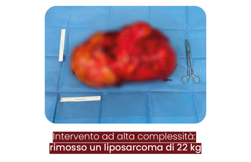 copertina immagine intervento liposarcoma